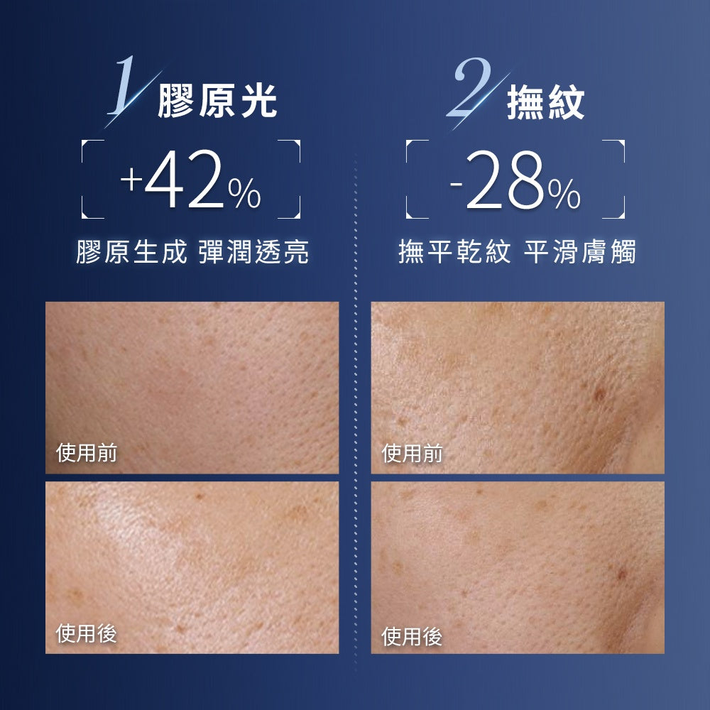 蘭蔻 超極限肌因精華露150ml 小黑水 小黑瓶PRO 化妝水 精華｜LANCOME官方旗艦店